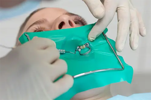 Dental dam placement during root canal procedure at Cosmodontist Clinic