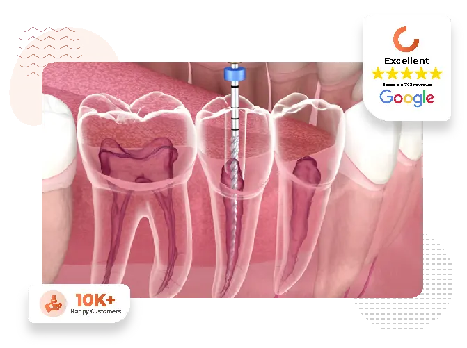 Root canal treatment at Cosmodontist Dental Clinic
