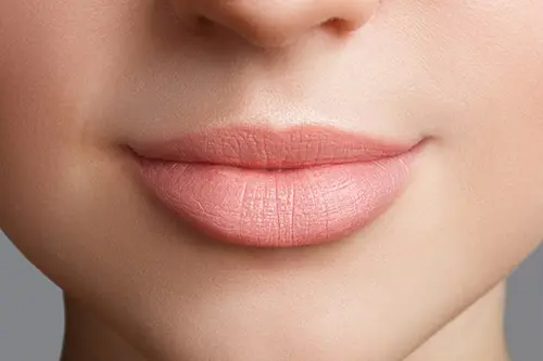 Fuller lips smile enhancement illustration