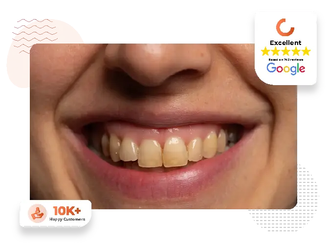 avoid yellowing teeth